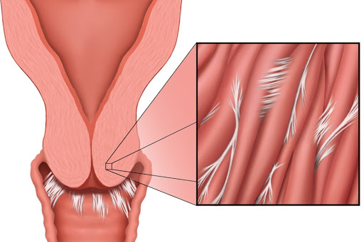 Cervix Penetration Stories the hoodxxx