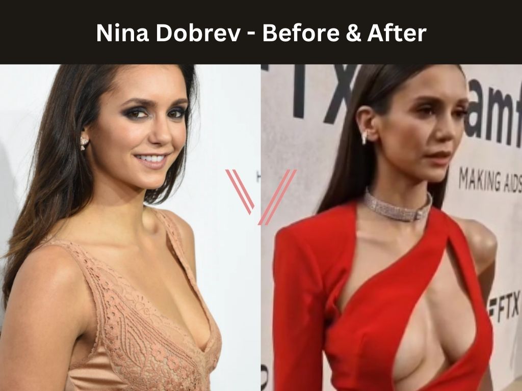 nina dobrev tits