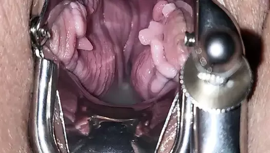 internal vagina camera