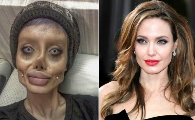 Best of Plastic surgery porn