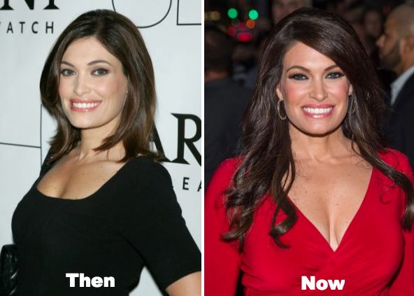 dawn shotton share kimberly guilfoyle boobs photos