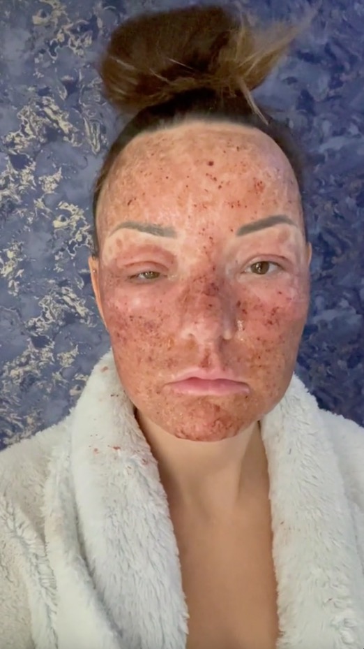 candace nicole lee recommends Leaked Facials